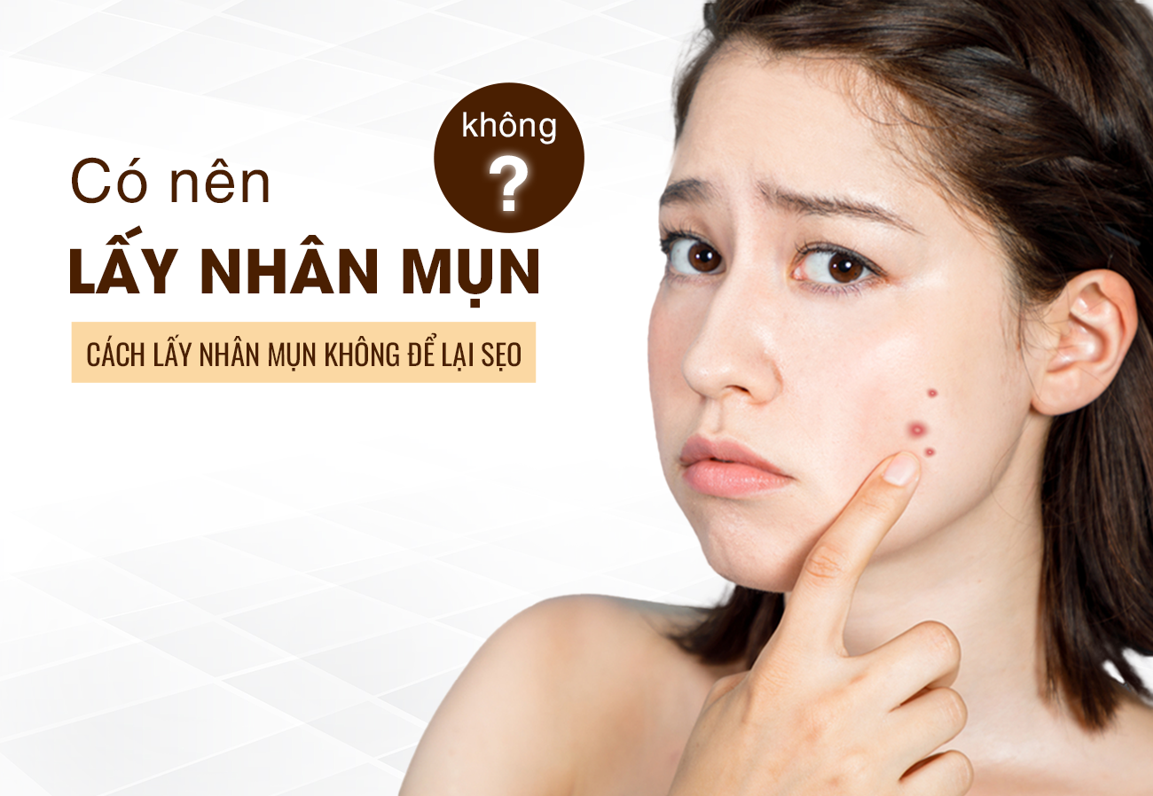 Có Nên Lấy Nhân Mụn Không? 